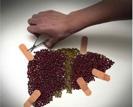 乙肝會不會傳染