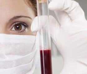 鄭州肝病醫(yī)院提醒:秋季不要忘記給父母做肝功能檢查